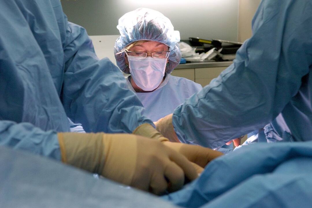 cirurgia de aumento do pênis